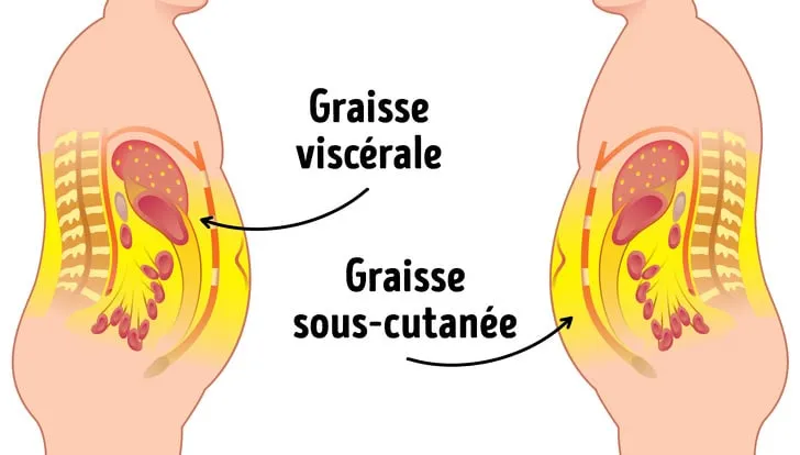 Schéma représentant la localisation et la répartition de la graisse viscérale et sous-cutanée.
